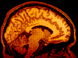 An MRI taken at the cognition and neuro-imaging lab of UA professor Lee Ryan. An MRI taken at the cognition and neuro-imaging lab of UA professor Lee Ryan.